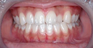 case4_1